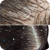 Scalp issues